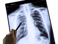 Diagnóstico Médico